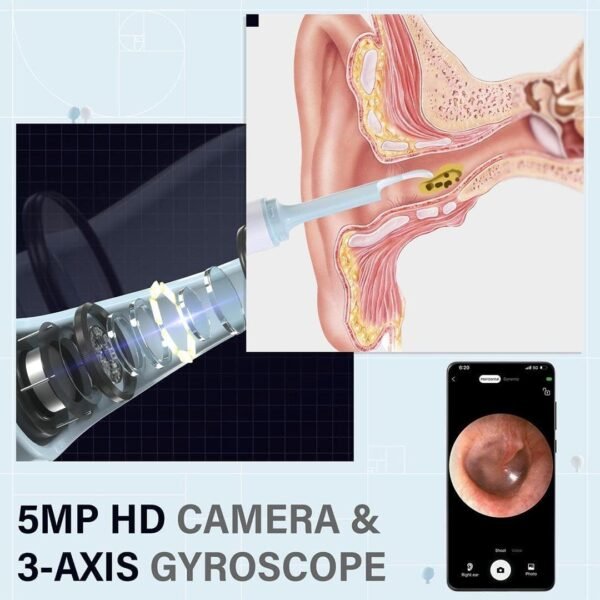 Otoscope nettoyeur d'oreilles – Image 11