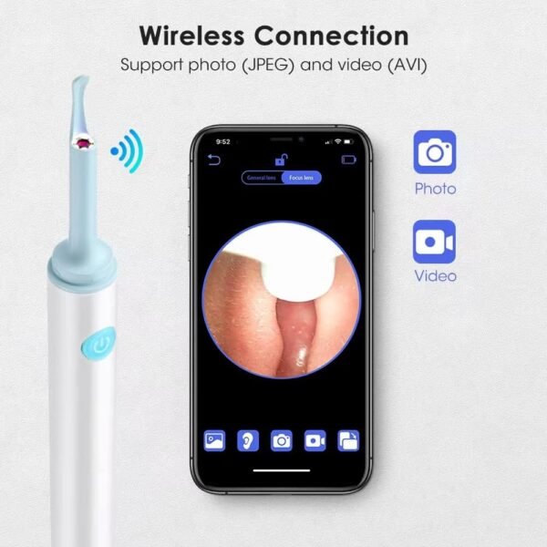 Otoscope nettoyeur d'oreilles – Image 13