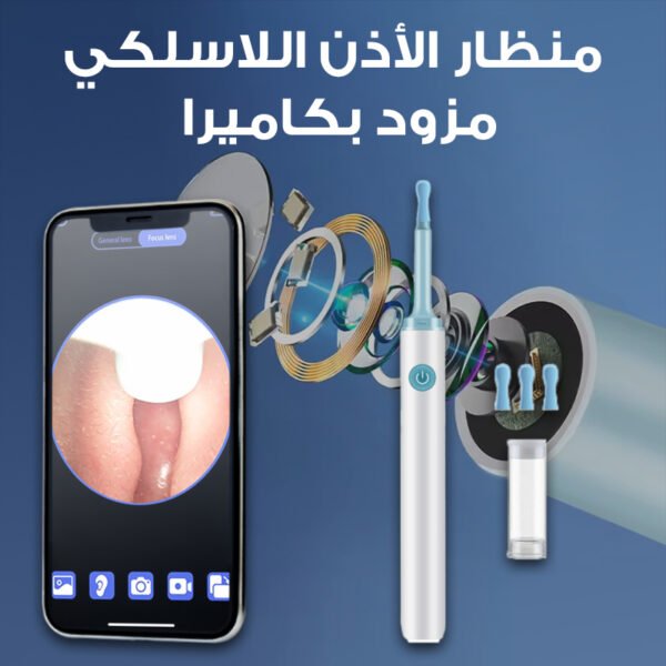 Otoscope nettoyeur d'oreilles – Image 2